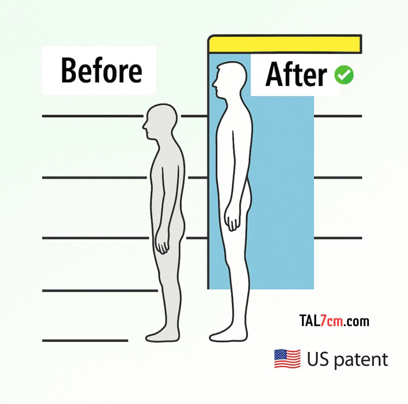 نتائج جهاز تي اي ال - قبل وبعد